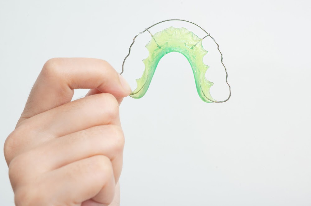 How-to-Take-Care-of-Your-Retainer