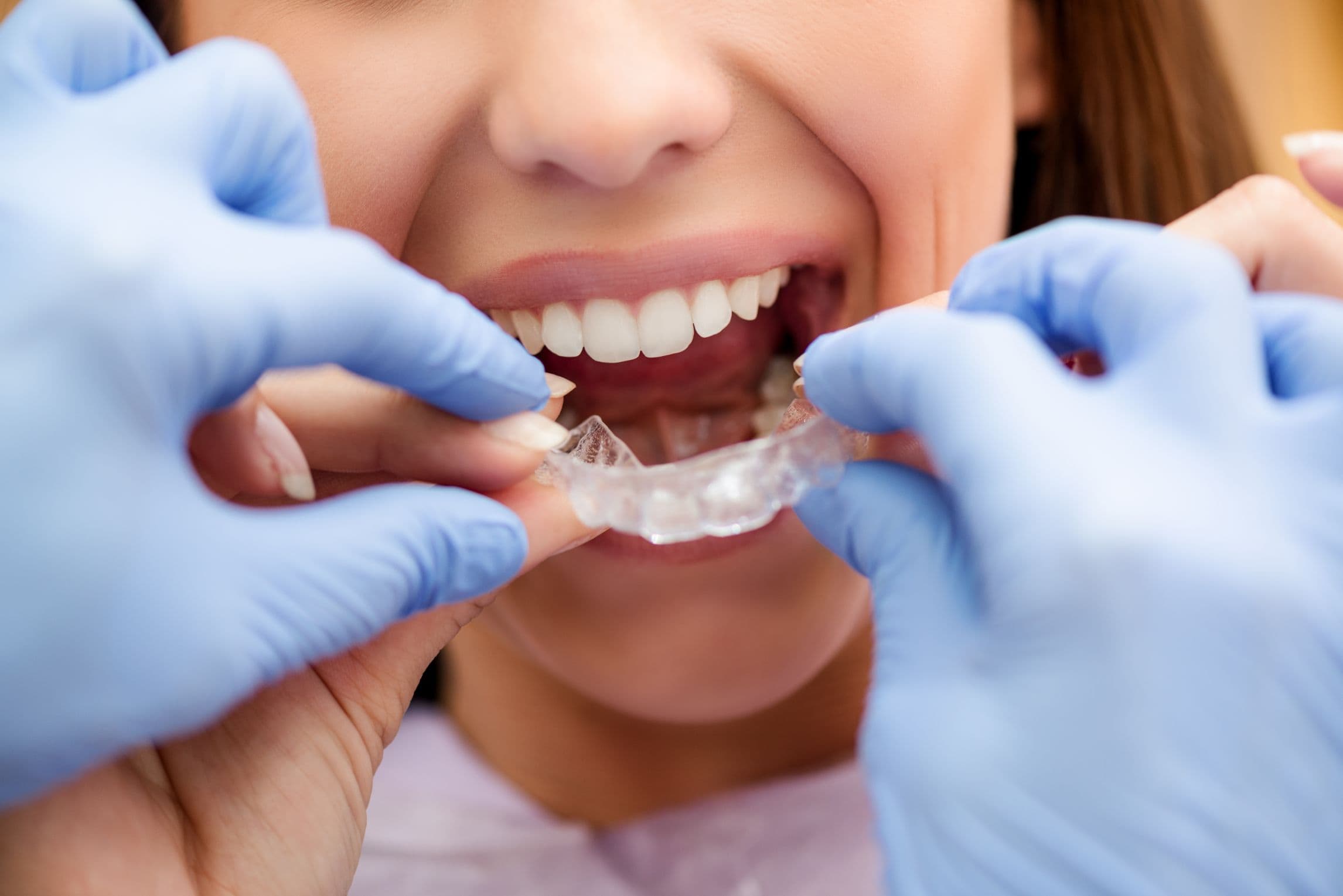 Invisalign Provider In Boynton, FL